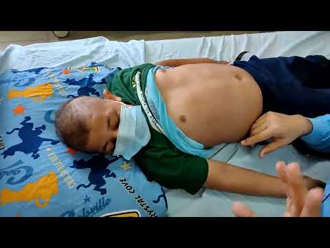 Abdomen examination in  pediatrics