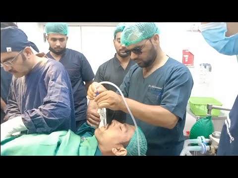 General anesthesia for #appendix procedure | #Anaesthesia #ETT