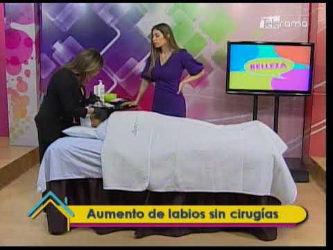 Aumento de labios sin cirugías