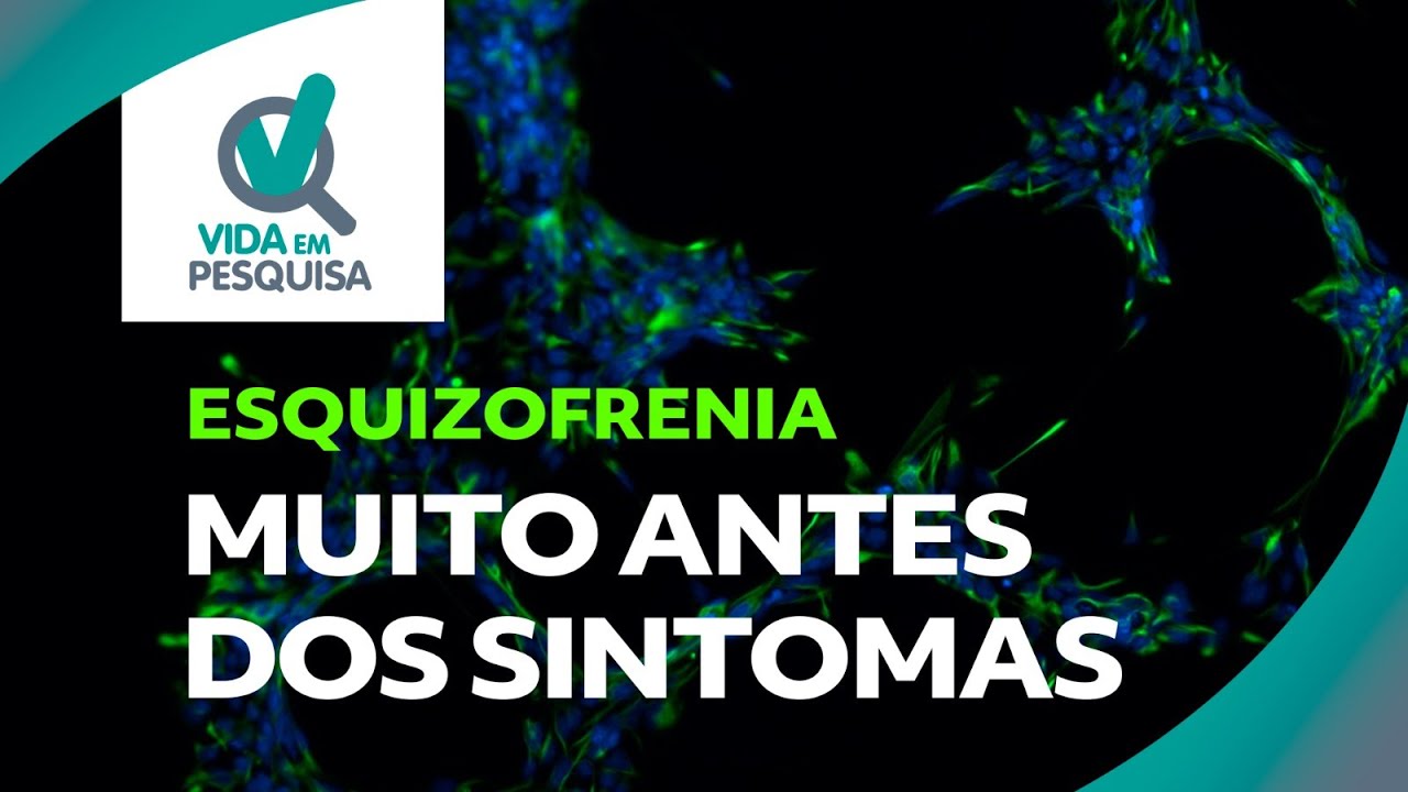 Esquizofrenia começa no desenvolvimento do cérebro
