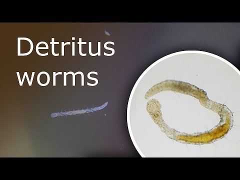 Detritus Worms: What Is It and How to Get Rid of Them. Detritus Worms Under a Microscope
