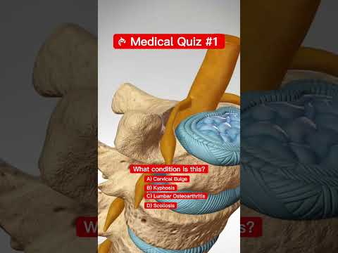Guess The Spine Injury And Procedure Challenge
