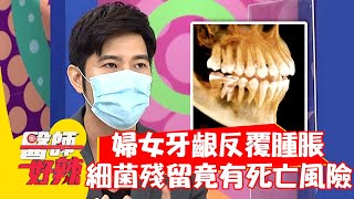 婦女牙齦反覆腫脹？細菌殘留竟有死亡風險？！【#醫師好辣】20210823 part1 EP1187 張棋惠 袁明琦