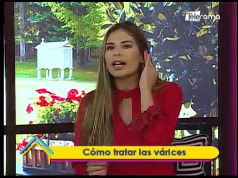 Dr. en Casa: Cómo tratar las várices 
