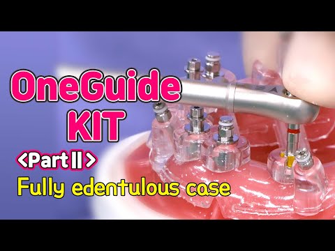 [EASY Hands-on] OneGuide KIT PartⅡ - Fully edentulous case