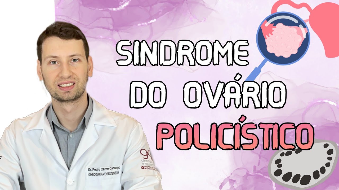 SOP: SINDROME DO OVÁRIO POLICÍSTICO tratamento