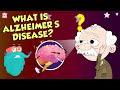What Is Alzheimer's Disease? | Brain Disease | The Dr Binocs Show | Peekaboo Kidz