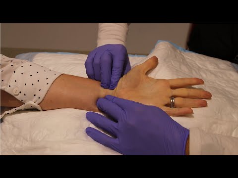 Modified Allen's Test