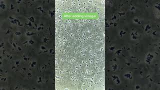 Vinegar VS Bacteria under the microscope!