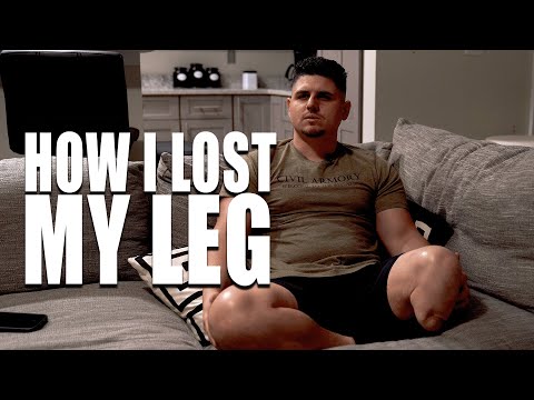 How I lost my leg