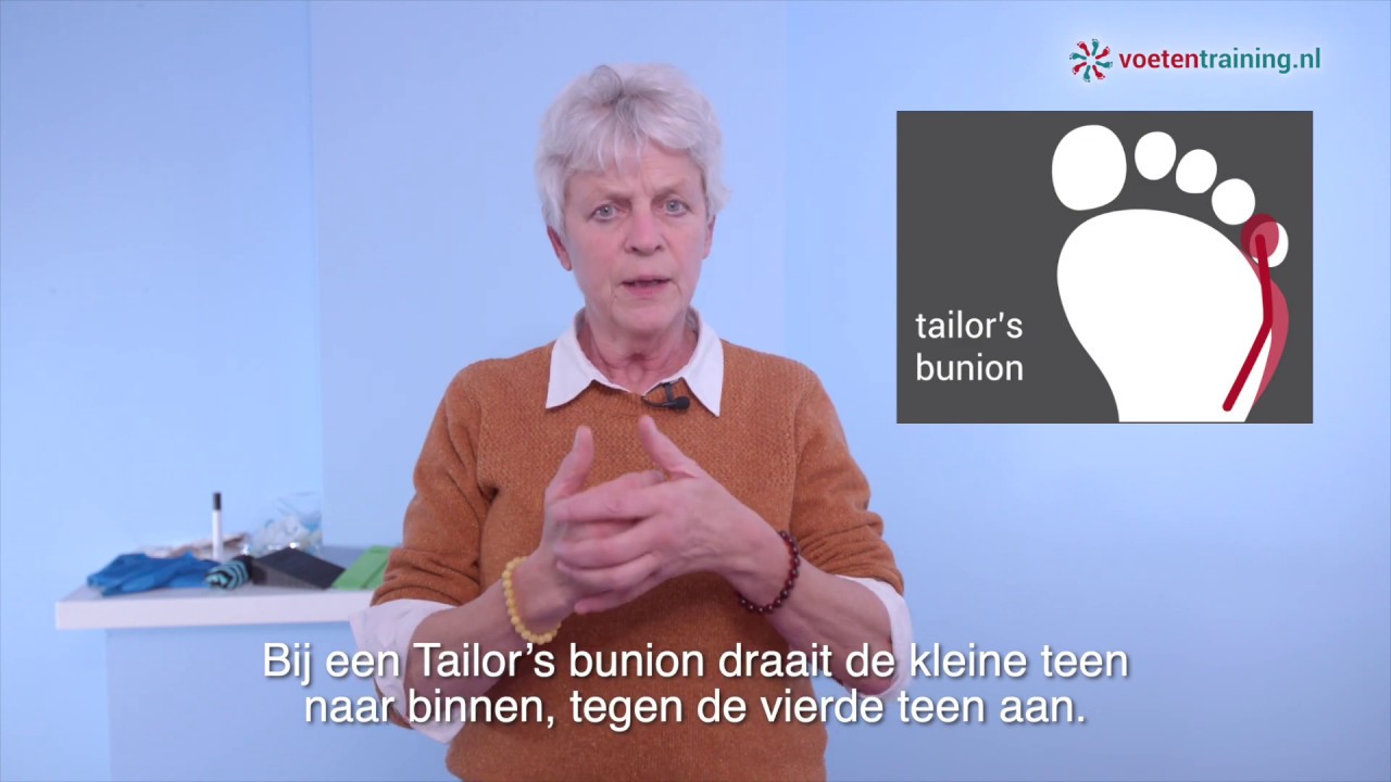Tailor's bunion