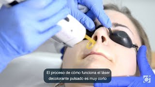 Tratamiento láser vascular, eliminación de manchas rojas.