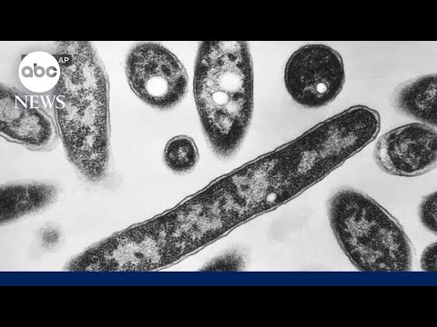 What to know about Legionnaires' disease