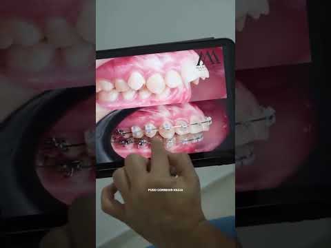 video 5ePD52mA0nI