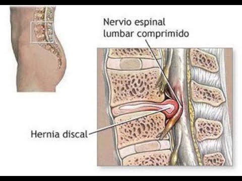 Néstor Iván López Torres-3