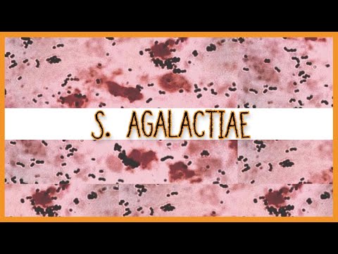 Streptococcus Agalactiae