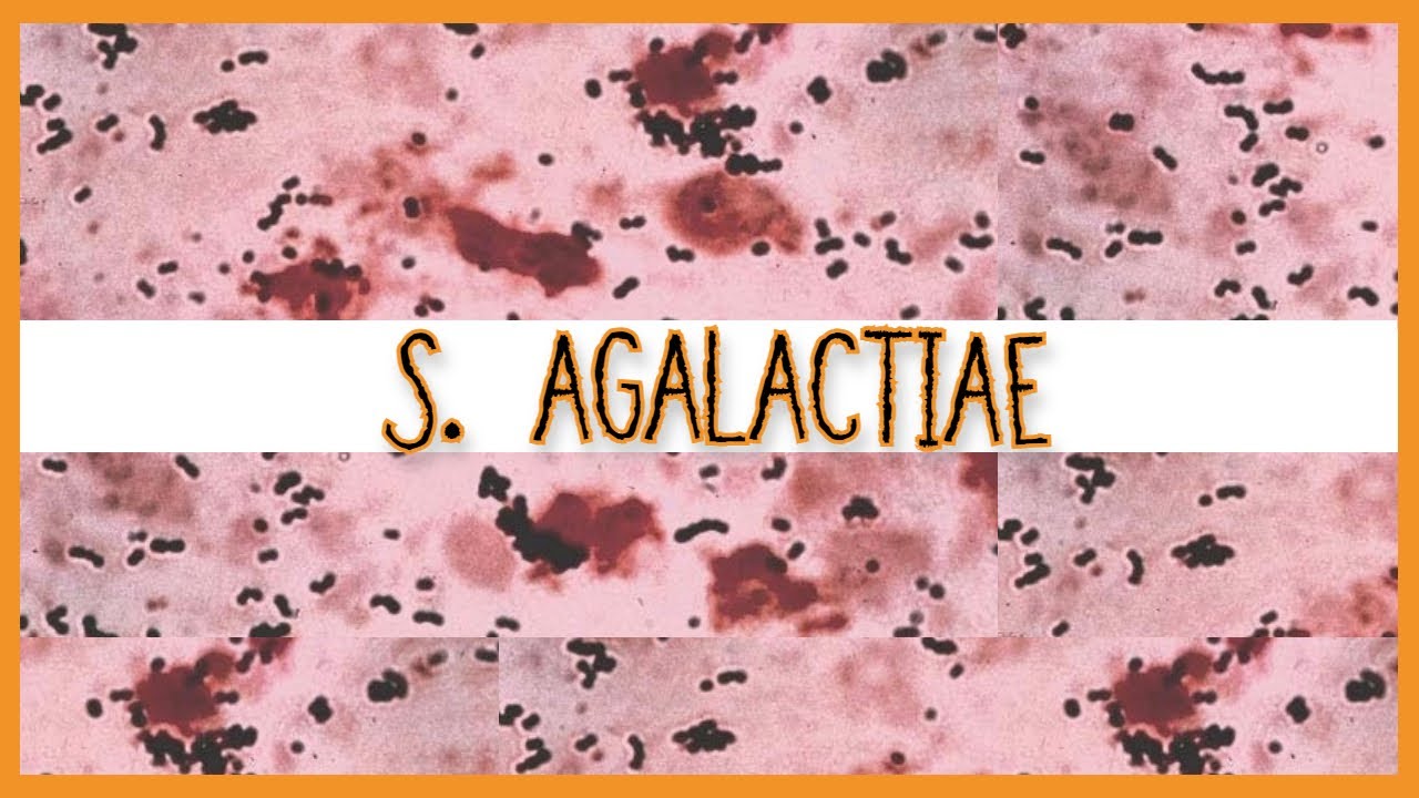 Streptococcus Agalactiae