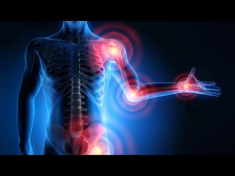 Térd osteoarthrosis kezelése 1 fokos kezelés