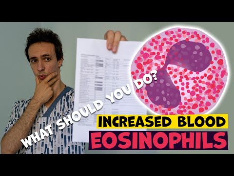 High blood EOSINOPHILS: causes and what to you do.