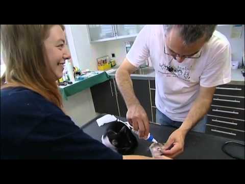 Prostata petrifikaty in Verschlimmerung der akuten Prostatitis