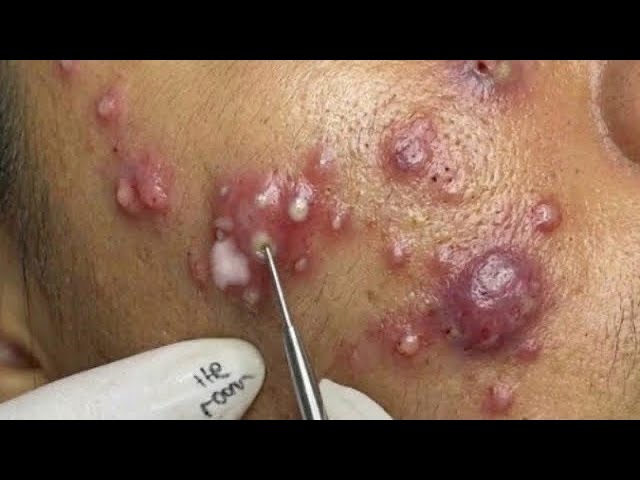 𝑨𝒄𝒉𝒊𝒆𝒗𝒆 𝑰𝒏𝒏𝒆𝒓 𝑷𝒆𝒂𝒄𝒆 𝑾𝒊𝒕𝒉 𝑻𝒉𝒆𝒔𝒆 𝑭𝒂𝒄𝒊𝒂𝒍 𝑪𝒍𝒆𝒂𝒏𝒔𝒊𝒏𝒈 𝑴𝒆𝒕𝒉𝒐𝒅𝒔 #445737