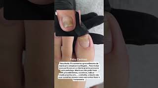 Limpeza e cutilagem