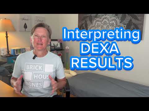 How to Understand Your DEXA Bone Density Scan Results