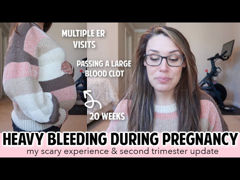 BLEEDING IN PREGNANCY - FIRST & SECOND TRIMESTER BLEEDING | SUBCHORIONIC HEMATOMA? PLACENTA PREVIA?