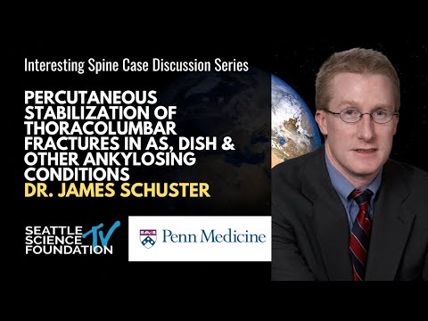 Percutaneous Stabilization of Thoracolumbar Fractures - James Schuster, M.D.