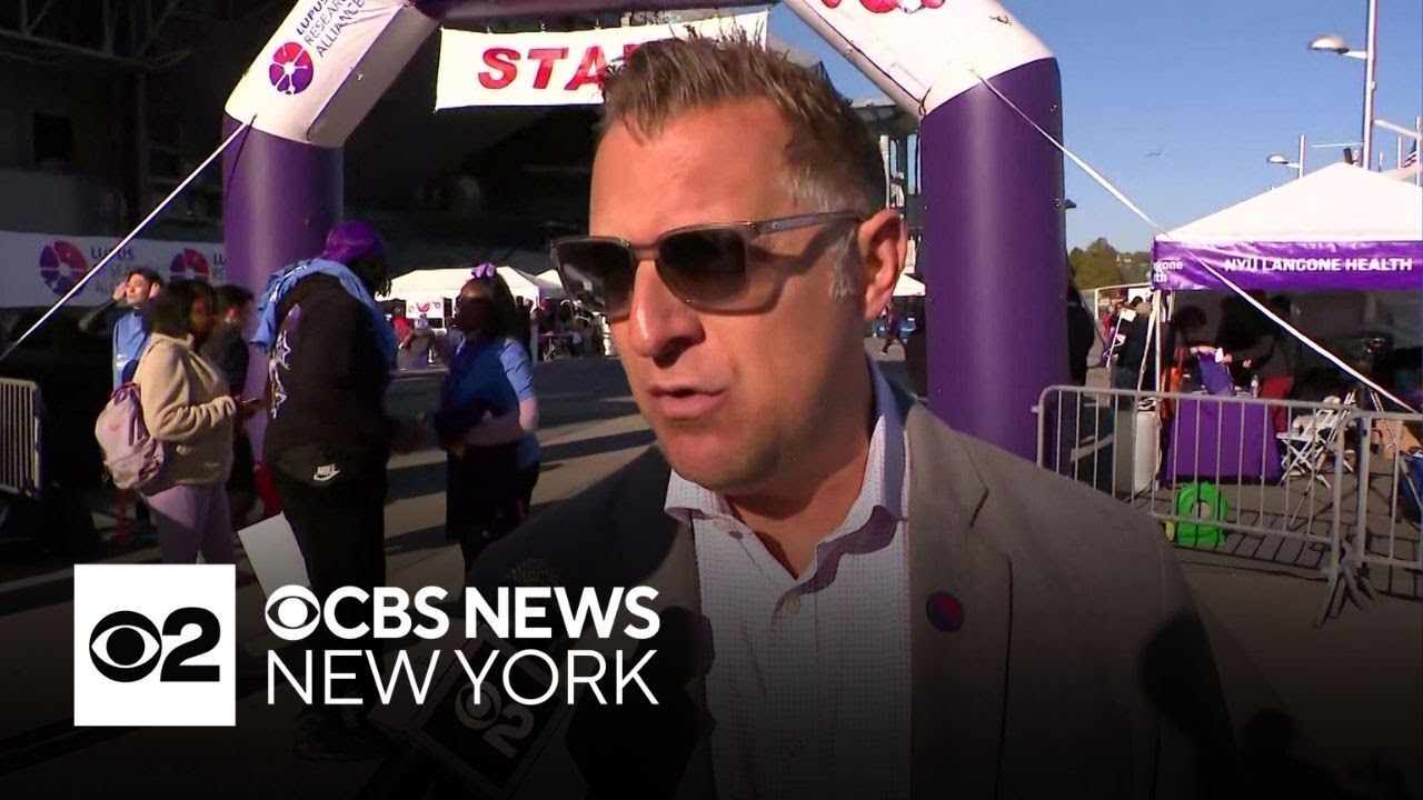 New lupus therapies could be approved soon, Lupus Research Alliance CEO says