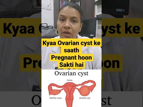 Kya ovarian cyst me Pregnant ho Sakte Hain#ovariancysts