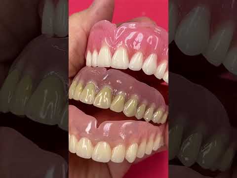 3 different denture characters!