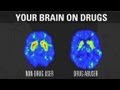 How addiction changes your brain