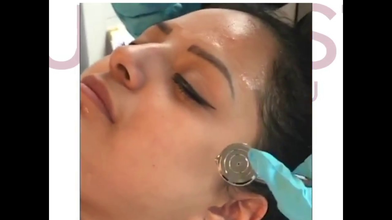 Facial Seattle