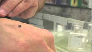 CHINCHES DE CAMA ATACAN NUEVA YORK