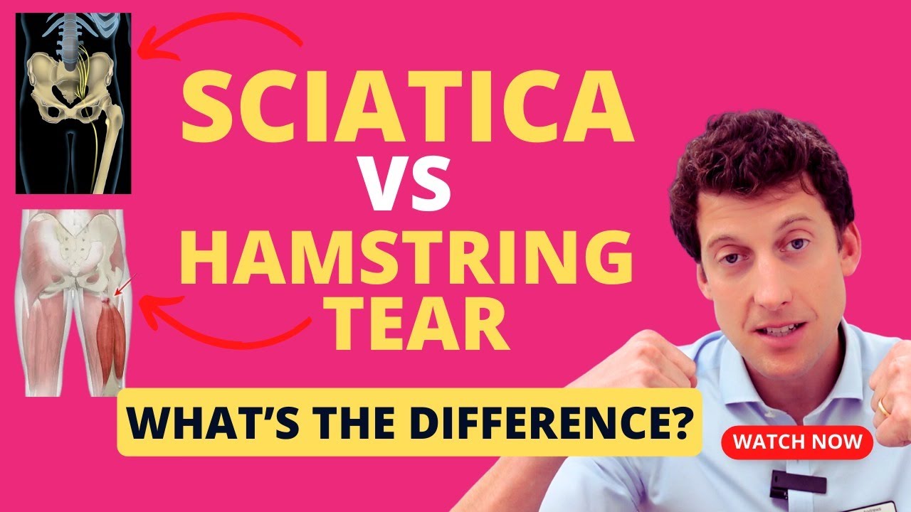 What is the difference between sciatica and a hamstring strain?
