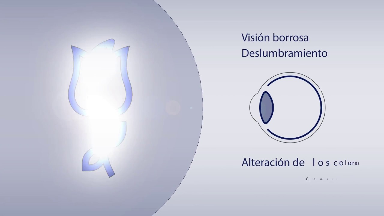 Álvaro Rodríguez Ratón-5