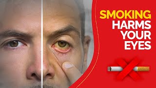 How smoking harms your eyes