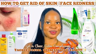 HOW TO GET RID OF SKIN| FACE REDNESS |Effective Skincare Products For Face Redness + Home remedies