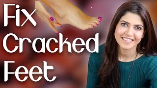 Fix Cracked Feet in Winters / Get Rid of Dry Feet Fast / Home Remedy  - Ghazal Siddique