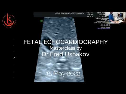 Fetal Echocardiography Masterclass 2022
