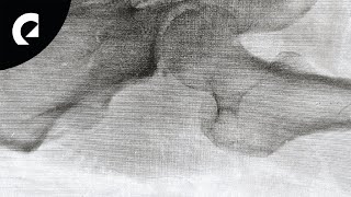Christoffer Moe Ditlevsen - From Stardust video