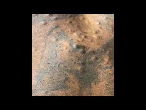 White Fat Removal from the Back