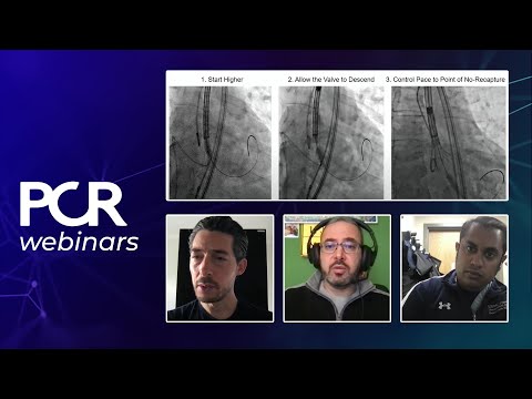 How to reduce permanent pacemaker (PPM) rate with cusp overlap technique? - Webinar
