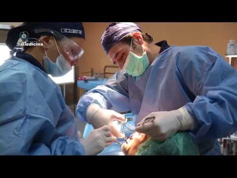 Trattamento della malattia degenerativa del disco cervicale con VSD Mal di protrusione della rotazione del disco che curare