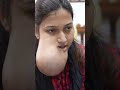 Poor Girl with very huge Face Tumor #shorts #medical - Richardsons Face Hospitals Poor Girl with very huge Face Tumor #shorts #medical