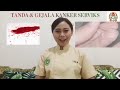 Pendidikan Kesehatan Tentang Kanker Serviks