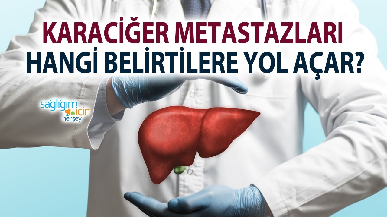 Metastatik Karaciğer Kanserleri Belirtileri