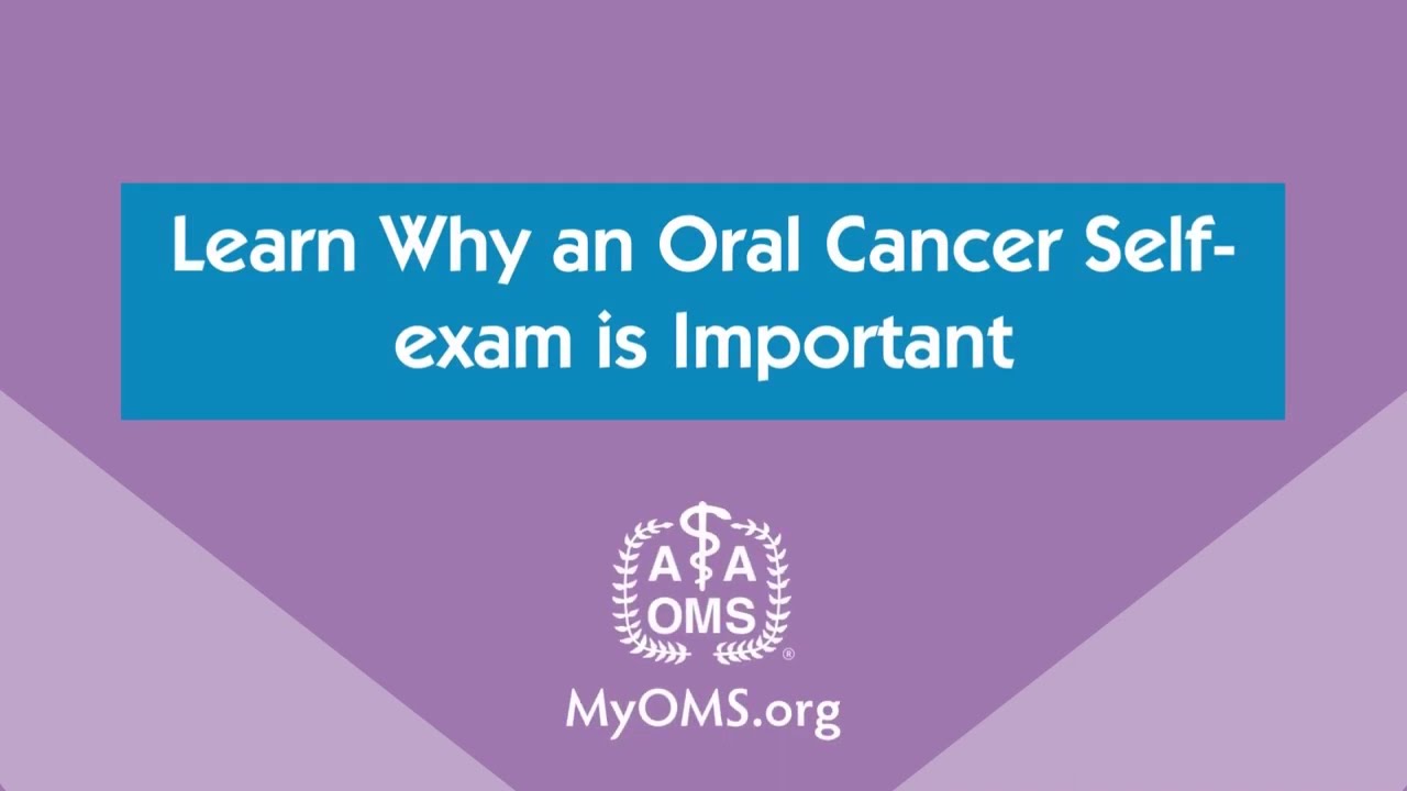 Learn Why an Oral Cancer Self-exam is Important