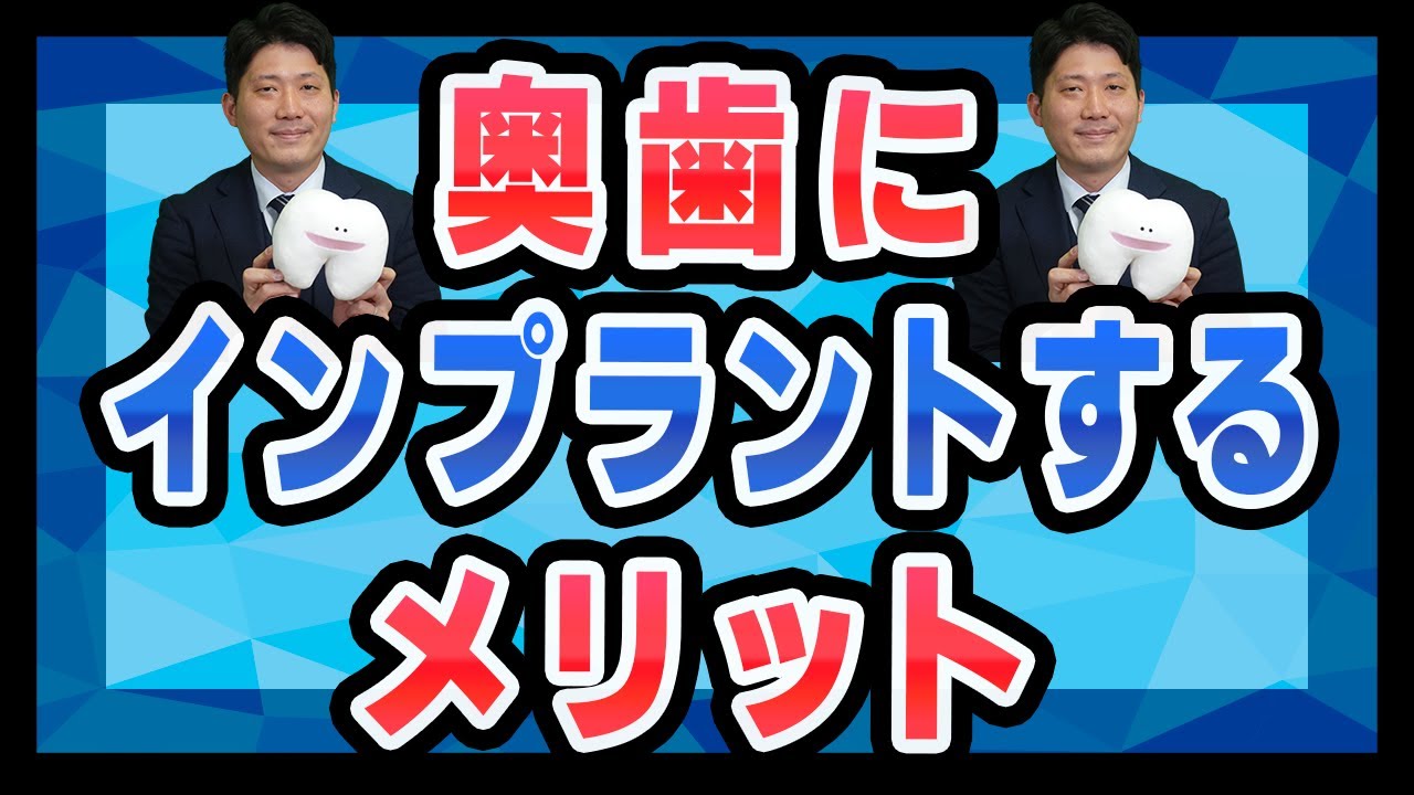 奥歯をインプラントにすることのメリットとデメリットを紹介!